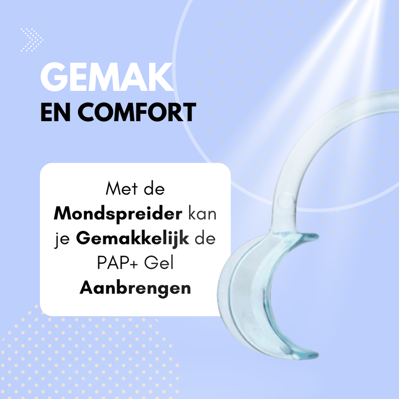 Handig thuis tandenbleken met een mondspreider